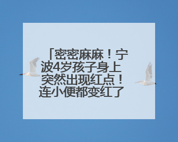 密密麻麻！宁波4岁孩子身上突然出现红点！连小便都变红了……家长：以为只是摔伤
